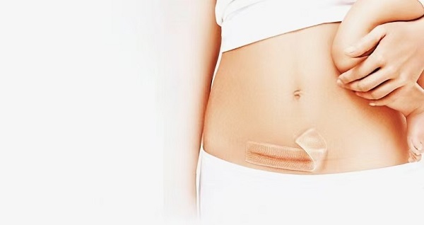 De ce sunt atât de populare foile groase de cicatrici cu gel de silicon?