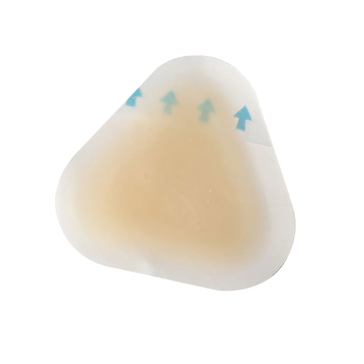 Prevenirea veziculelor sterile pentru călcâi: cum vă puteți proteja picioarele de durere, infecție și daune prin frecare